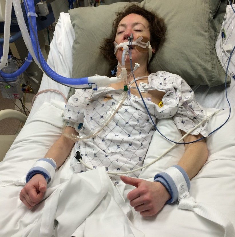 Rebecca asleep in a hospital bed on a ventilator with a thumb raised on one hand.